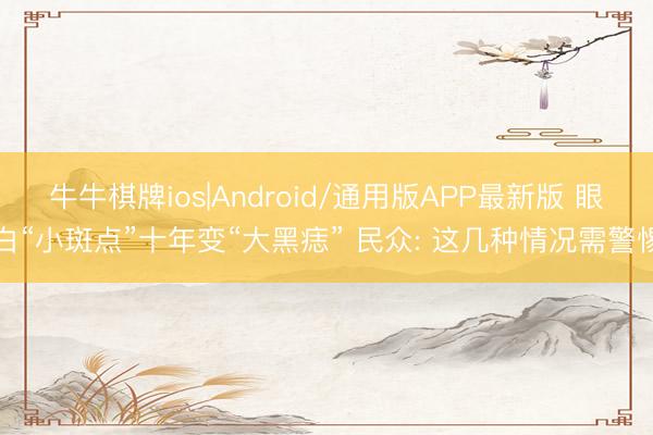 牛牛棋牌ios|Android/通用版APP最新版 眼白“小斑点”十年变“大黑痣” 民众: 这几种情况需警惕